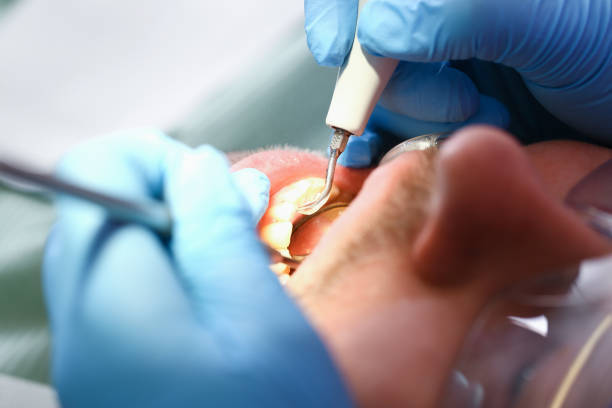 Best After-Hours Emergency Dentist in Mcgovern, PA