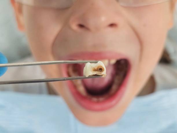 Best 24-Hour Emergency Dentist in Mcgovern, PA